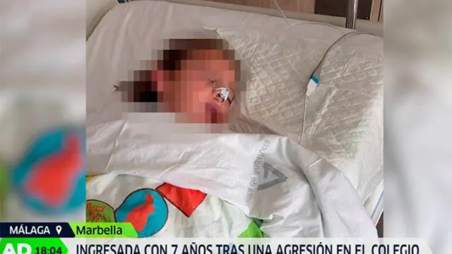 «Gorda fea» y «panchita», el acoso que acabó con una niña en el quirófano